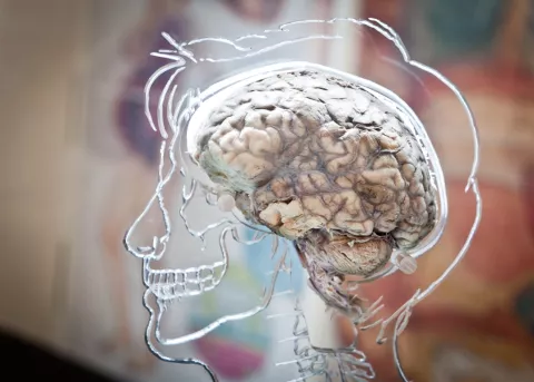 An exhibit of a human brain inside of an illustrative plexiglass