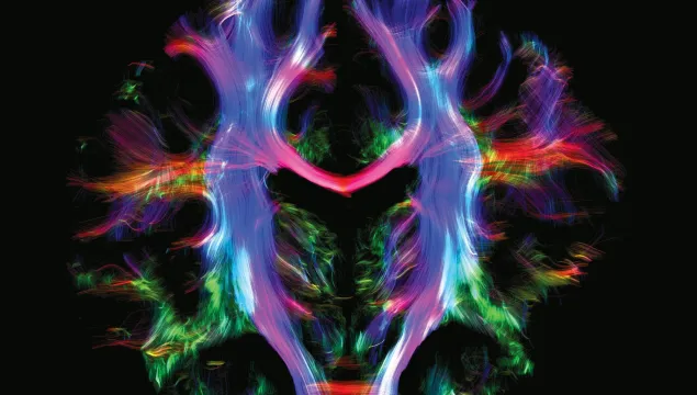 A colourful image of a brain scan
