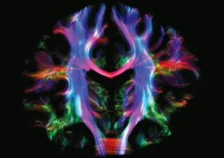 A colourful image of a brain scan 